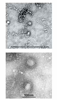 Primera imagen del aún 2019-nCov